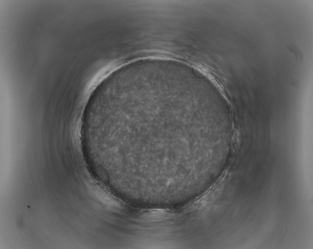 X0000111520151200908041251