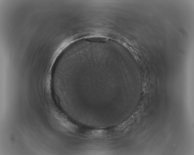 X0000111520152200908041251