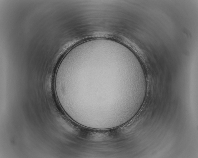X0000111520155200908041251