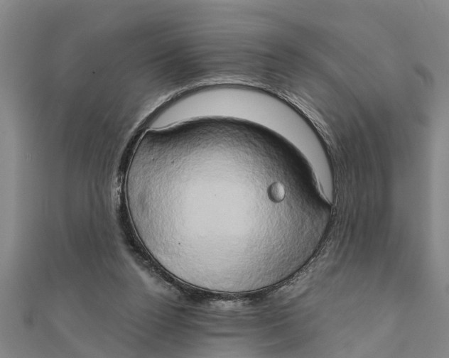 X0000111520160200908041251