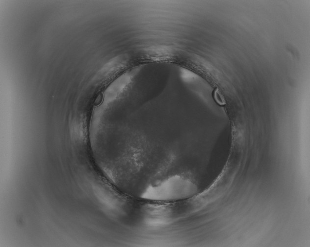X0000111520170200908041251