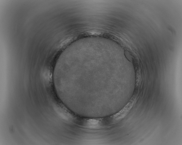 X0000111520176200908041251