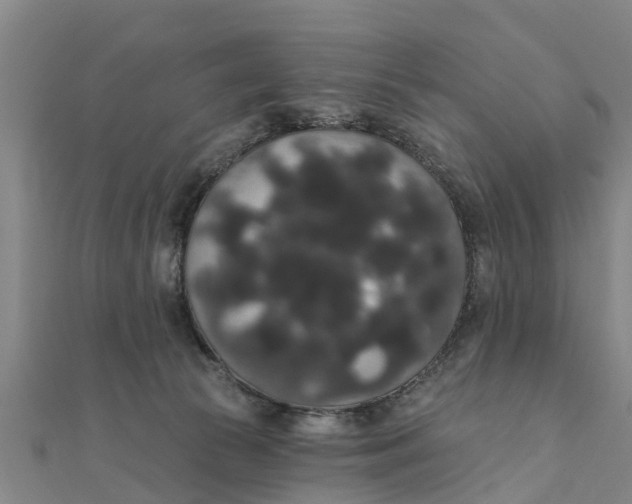 X0000111520177200908041251