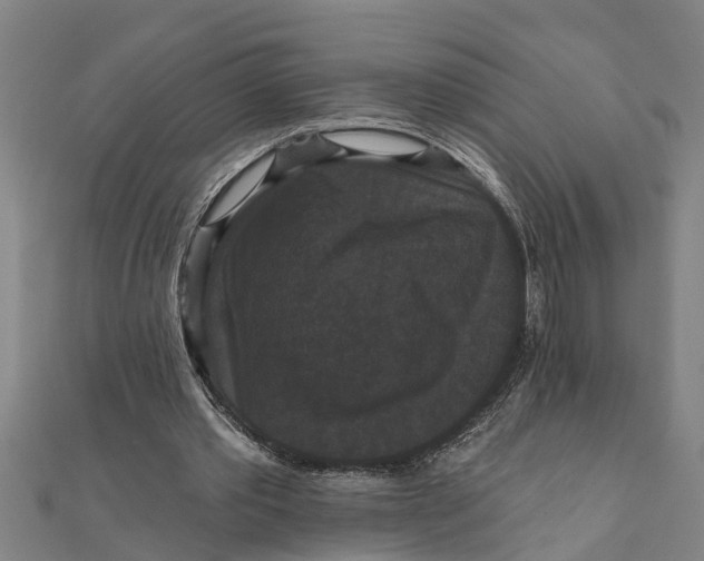 X0000111520389200908041248