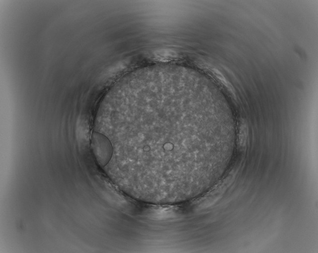 X0000111520569200908041246