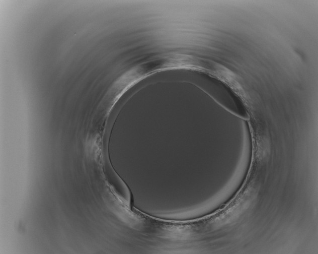 X0000111521369200908041235