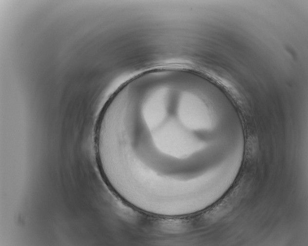 X0000111521470200908041233