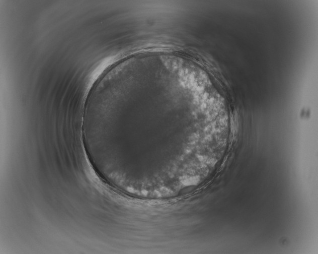 X0000111520003200908111213