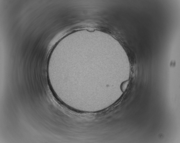 X0000111520004200908111213