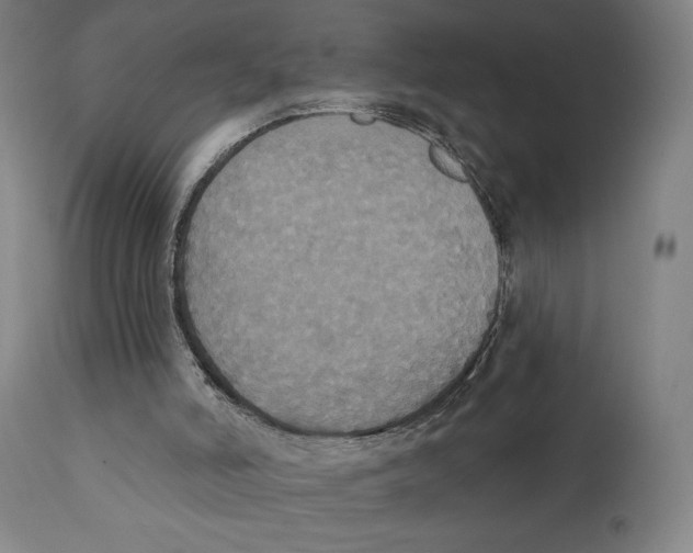 X0000111520006200908111213