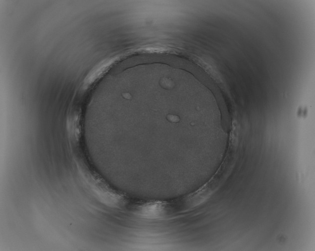 X0000111520116200908111212