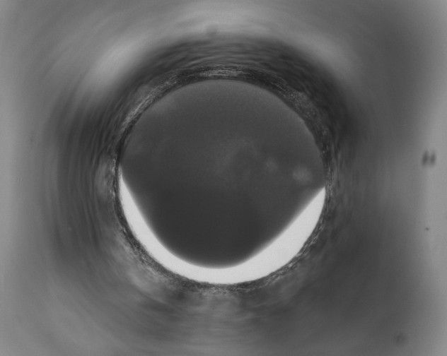 X0000111520146200908111210