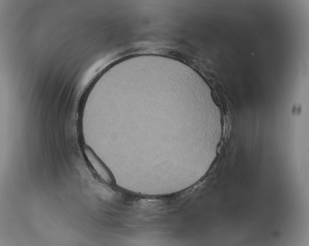 X0000111520150200908111210