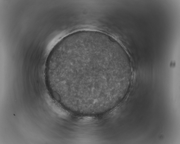 X0000111520151200908111210