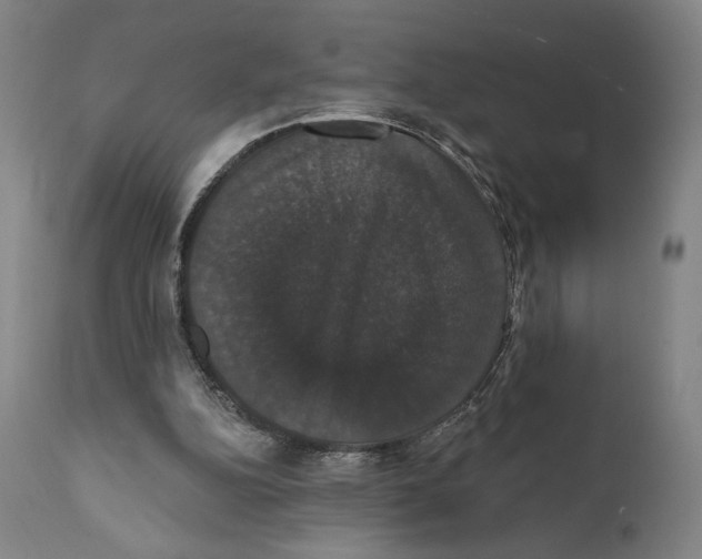 X0000111520152200908111210