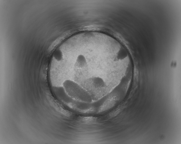 X0000111520153200908111210