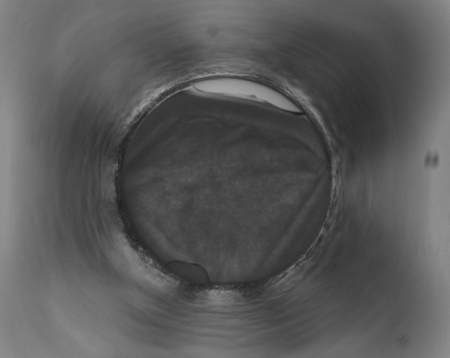 X0000111520154200908111210