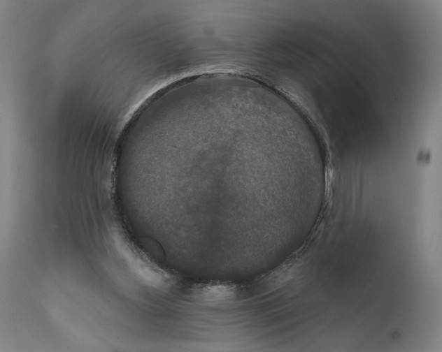 X0000111520156200908111211