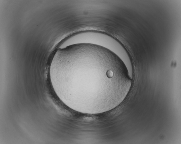 X0000111520160200908111211