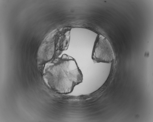 X0000111520161200908111211