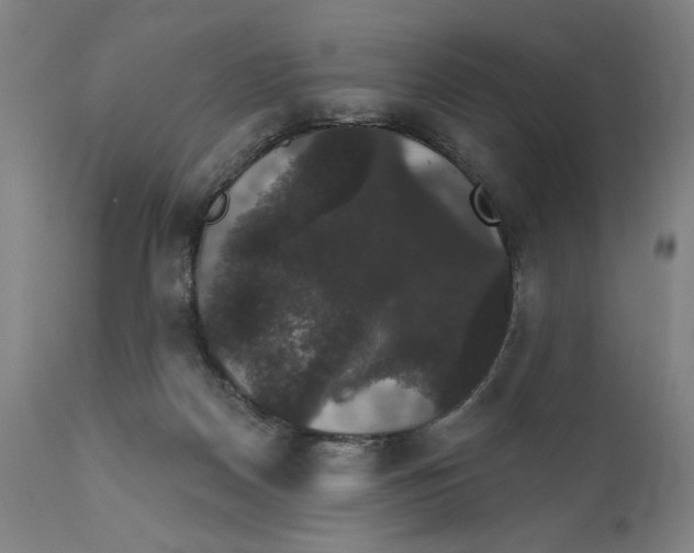 X0000111520170200908111211