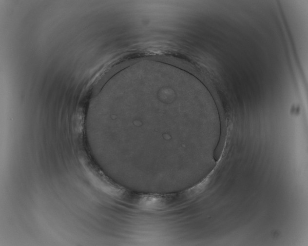 X0000111520174200908111211