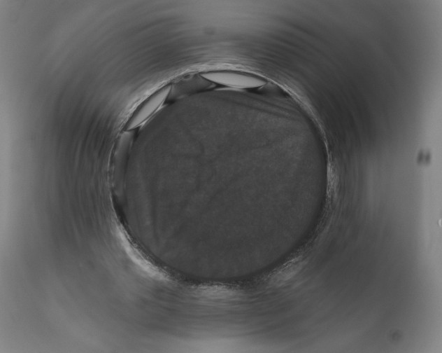 X0000111520389200908111207