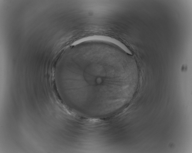 X0000111520528200908111205