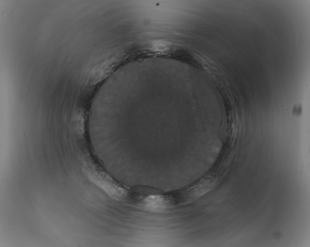 X0000111520562200908111205