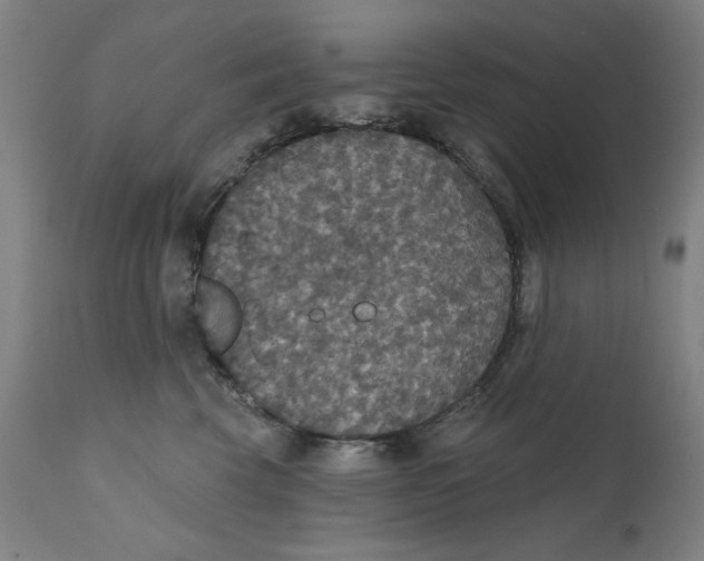 X0000111520569200908111205