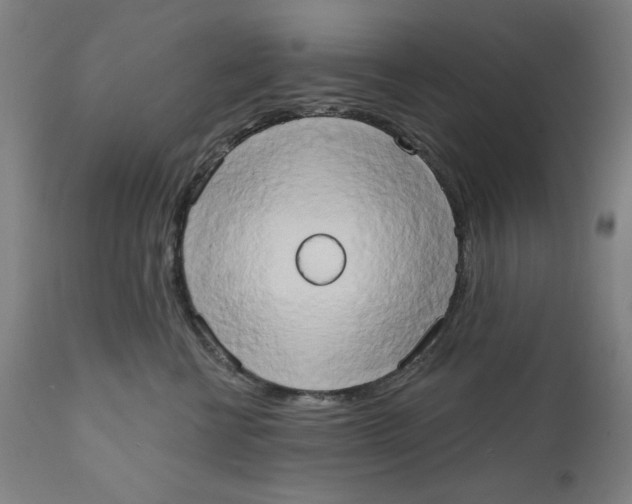 X0000111520570200908111205