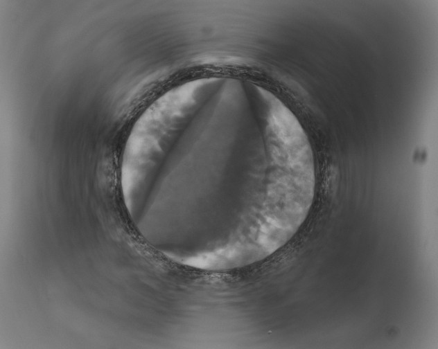 X0000111520966200908111158