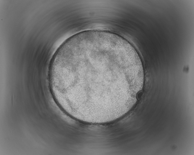 X0000111521091200908111156