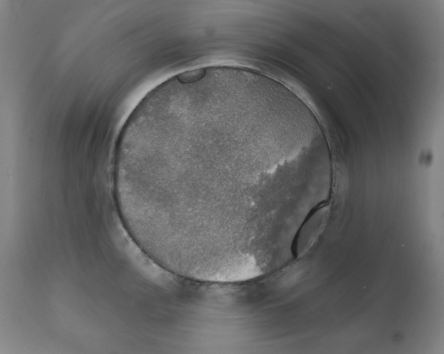 X0000111521148200908111156