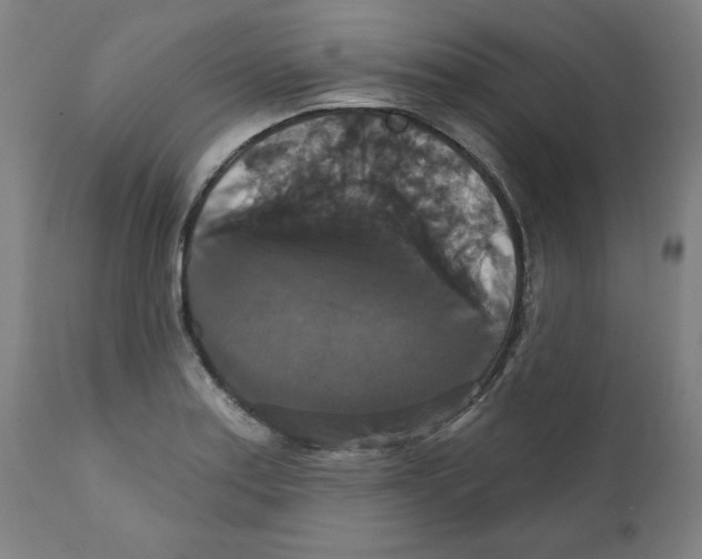 X0000111521179200908111155