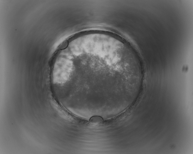 X0000111521360200908111152