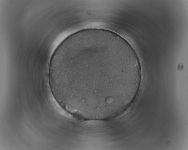 X0000111521392200908111152