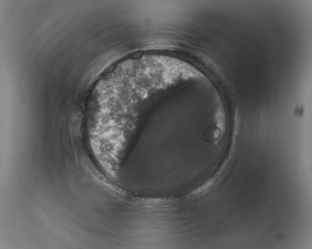 X0000111521401200908111151
