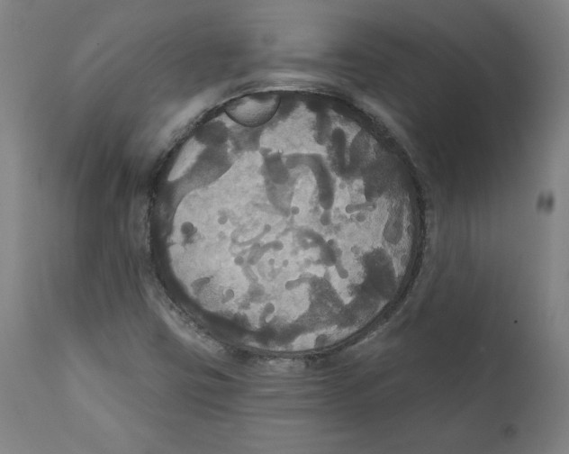 X0000111521403200908111151