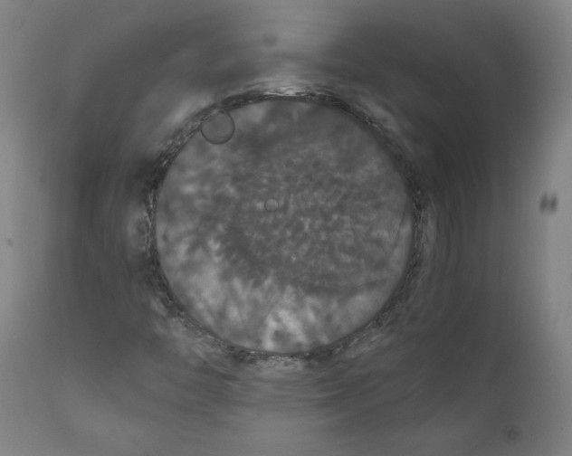 X0000111521446200908111151