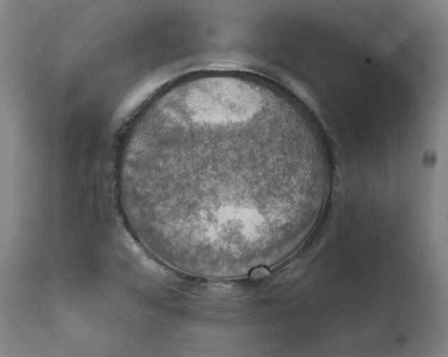 X0000111521456200908111151