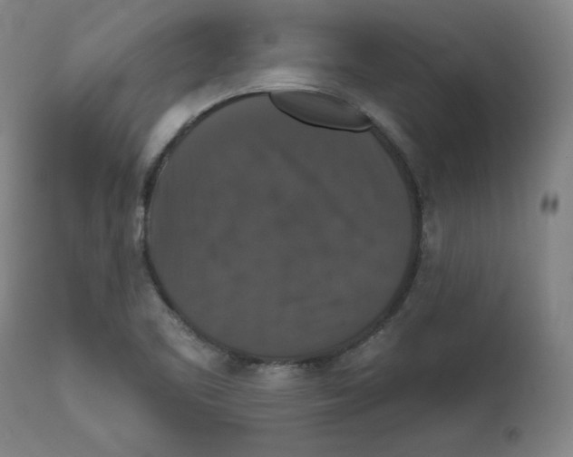 X0000111521461200908111151