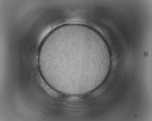X0000111521462200908111151