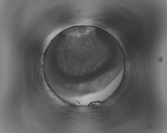 X0000111521480200908111151
