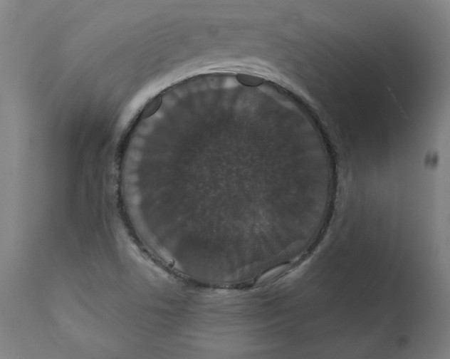 X0000111521506200908111150
