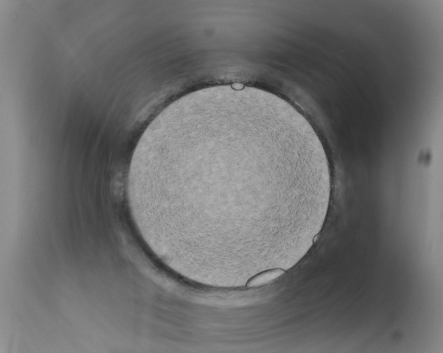 X0000111520017200908251149