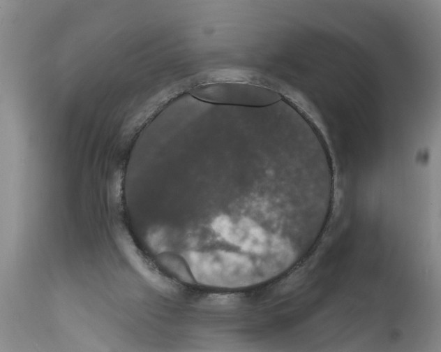 X0000111520057200908251148