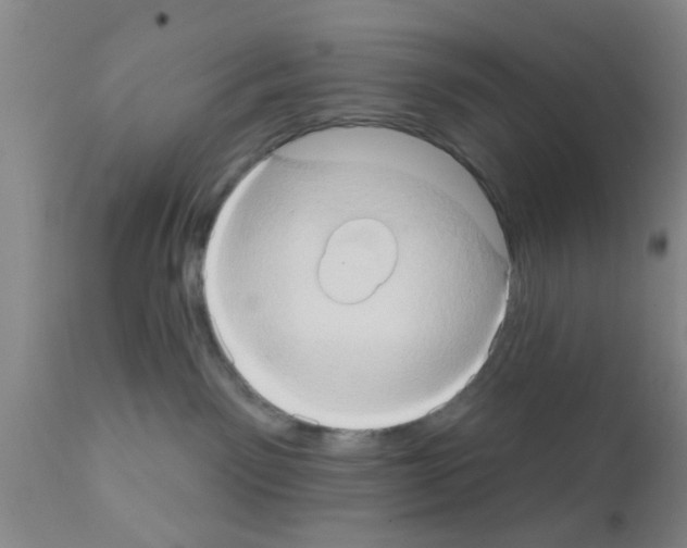 X0000111520141200908251147