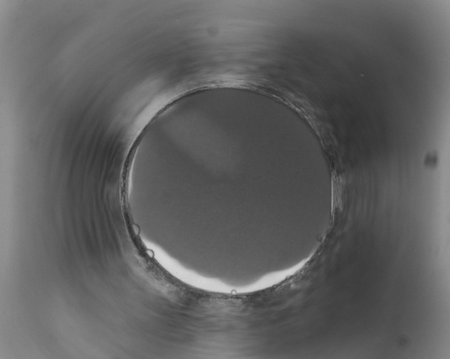 X0000111520147200908251146