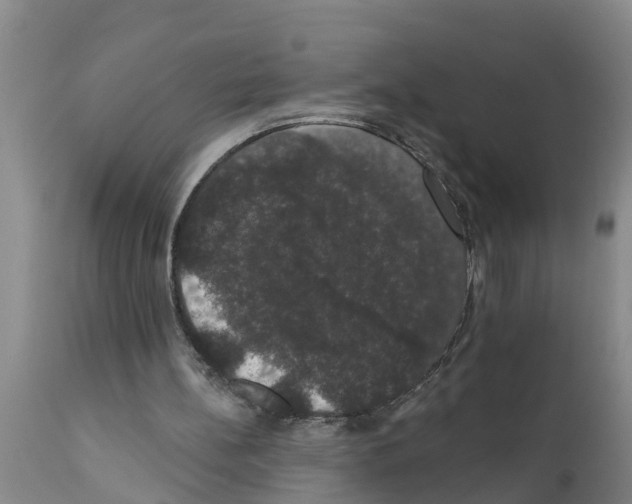 X0000111520148200908251146